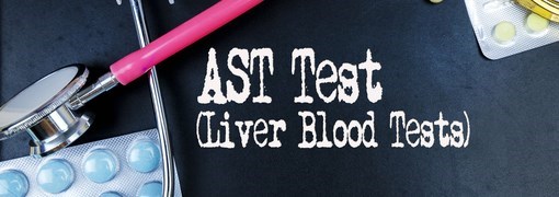 בדיקת רמת AST) Aspartate Aminotransferase) - תמונה